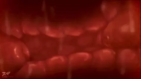 Pussy X-Ray (No Moaning, Flesh Sounds)